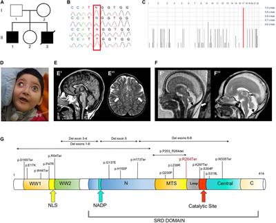 Loss of Wwox Perturbs Neuronal Migration and Impairs Early Cortical Development